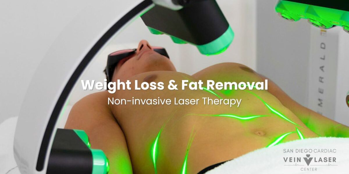 Emerald Laser Weight Loss and Fat Removal