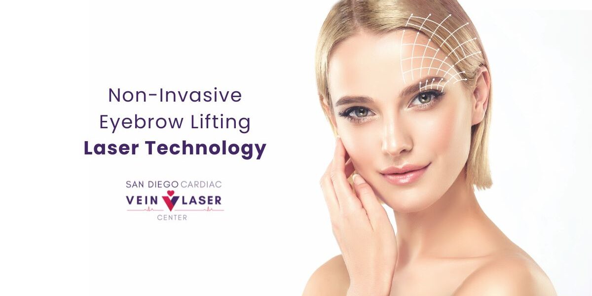 Eyebrow Lifting Laser Therapy FRAC3®
