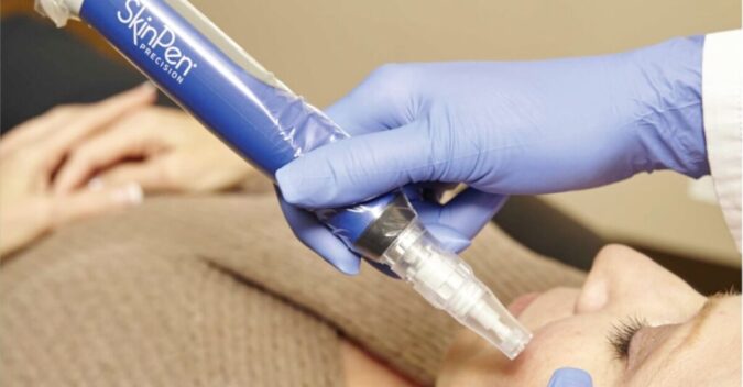 Microneedling SKINPEN® PRECISION