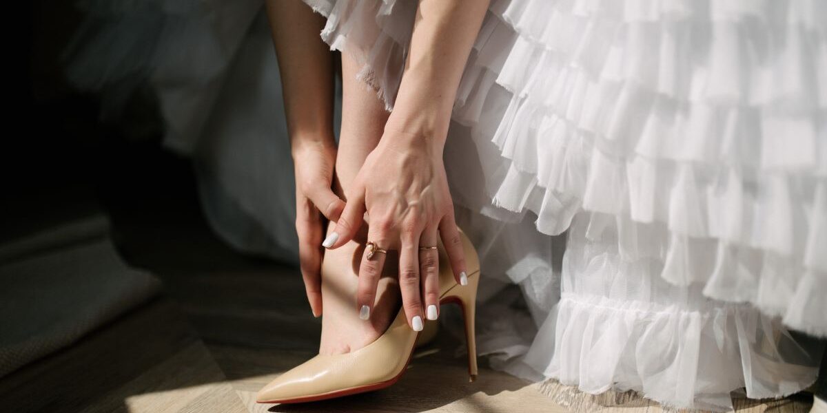 SD Vein Blog Sclerotherapy for Varicose and Spider Veins