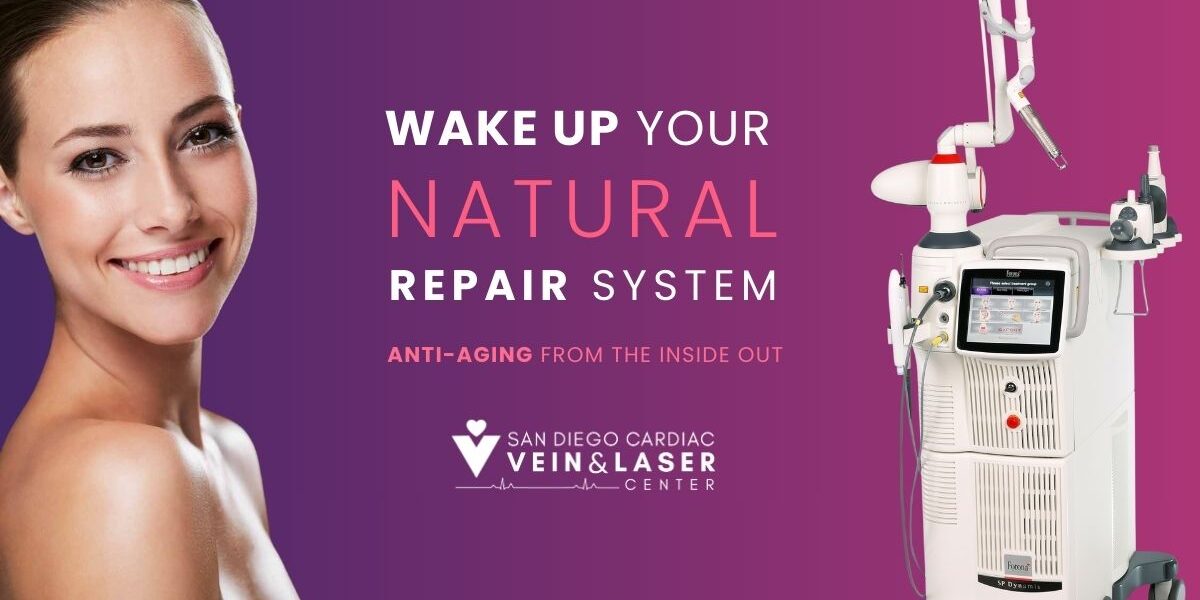 SD Vein Laser Vein & Anti-Aging Therapy