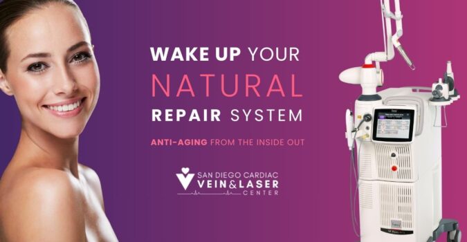SD Vein Laser Vein & Anti-Aging Therapy