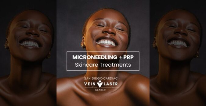 Microneedling with PRP