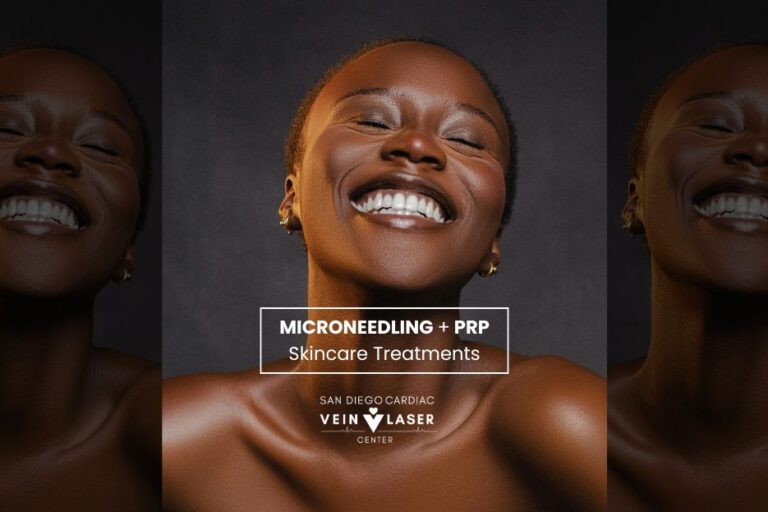 Microneedling with PRP