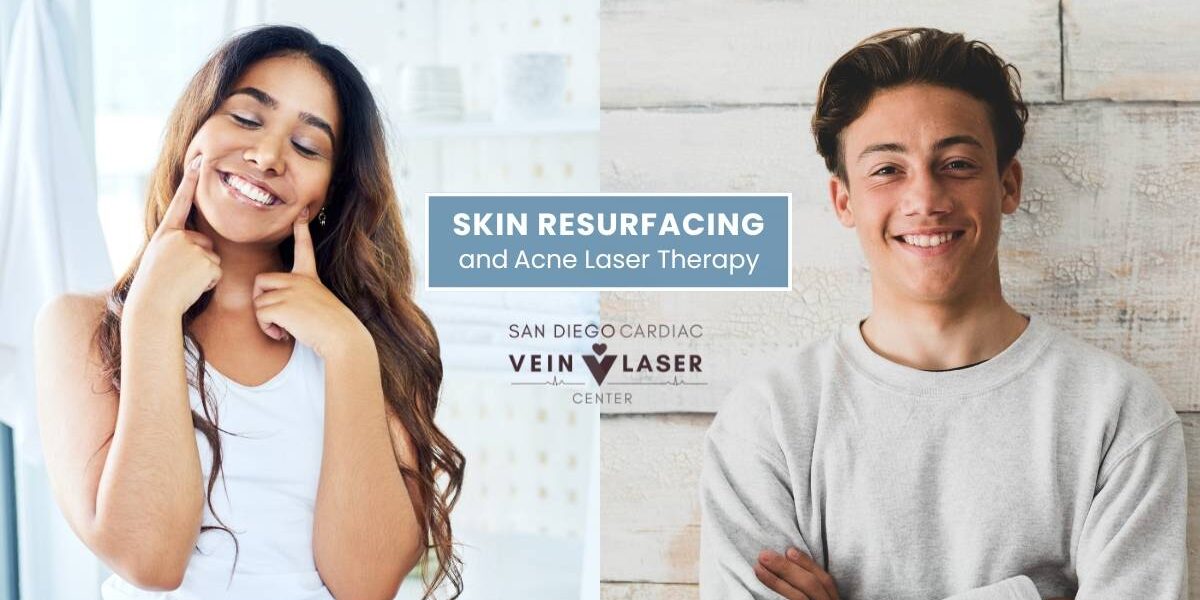 SD Vein Skin Resurfacing and Acne Laser Therapy (1200 x 623 px)