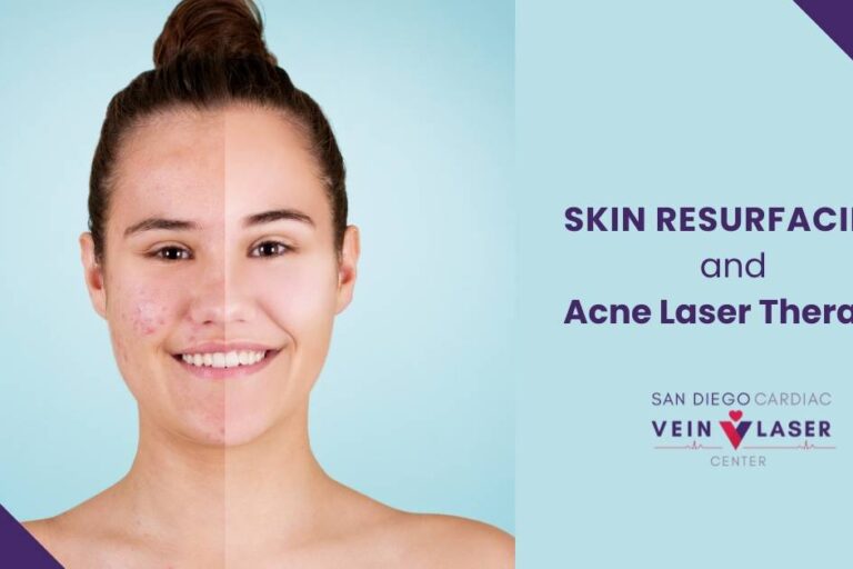 Vein & Laser Treatment San Diego Cardiac Vein and Laser Center