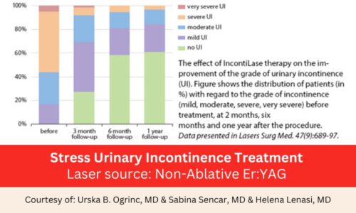 Vaginal Tightening and Urinary Incontinence