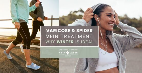 Varicose & Spider Vein Treatment Why Winter Is Ideal
