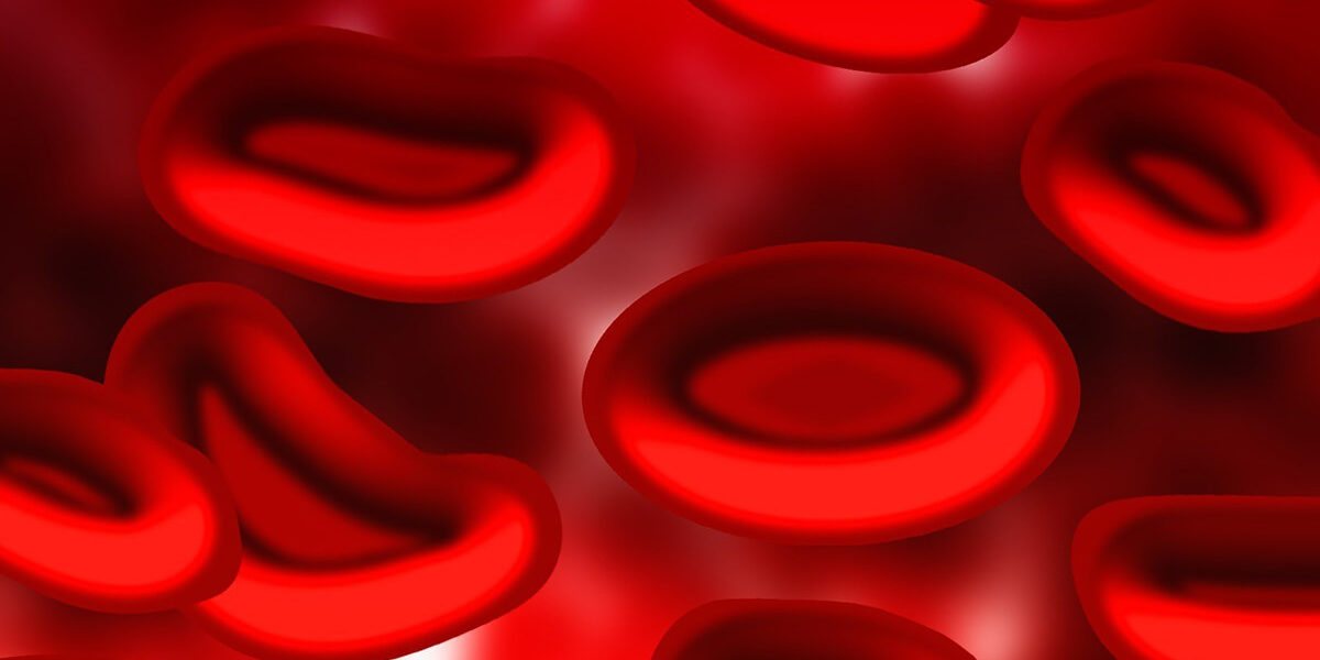 what-you-need-to-know-about-varicose-veins-and-blood-clots